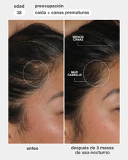 FutureIQ™ sérum biomimético para la longevidad capilar k18